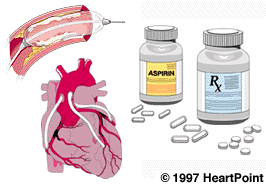 Symptoms treatments and cures of coronary heart disease