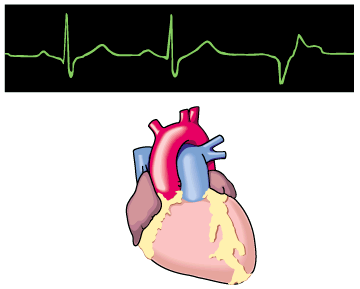 staticheart.gif (11713 bytes)